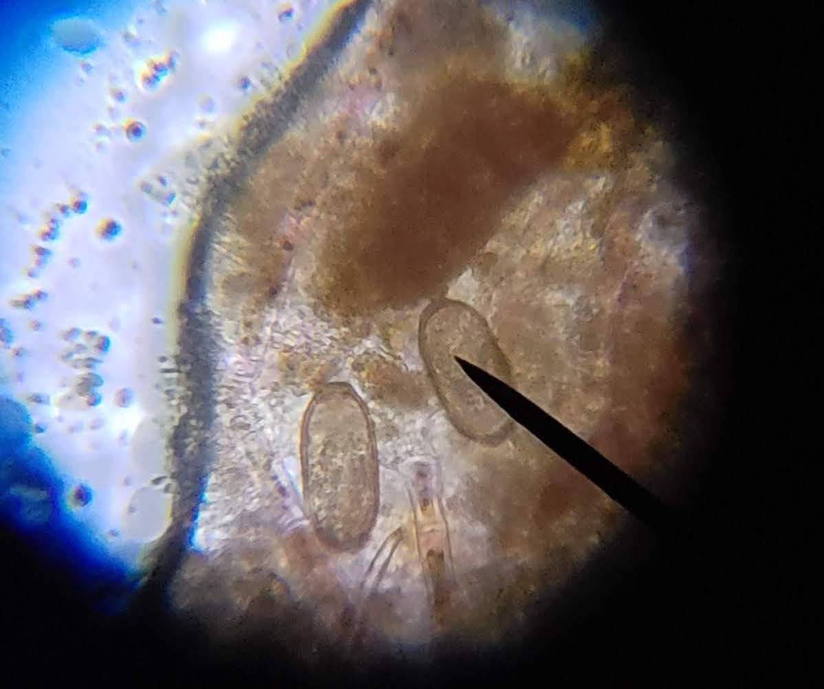 AmScope M150C 40X-1000X All-Metal Optical Glass Lenses Cordless LED Compound Biological Microscope customer photo 1