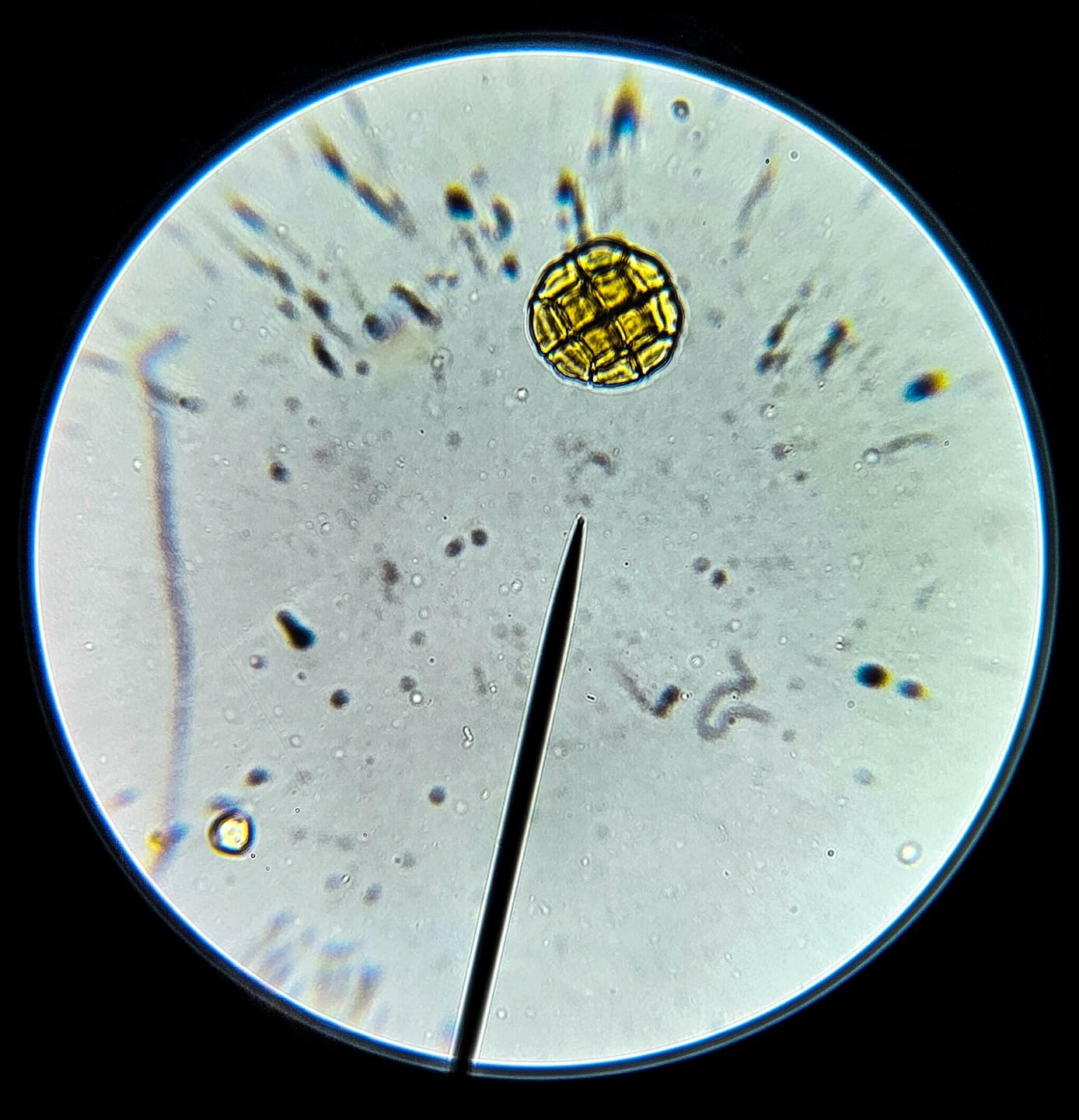 AmScope M150C 40X-1000X All-Metal Optical Glass Lenses Cordless LED Compound Biological Microscope customer photo 2