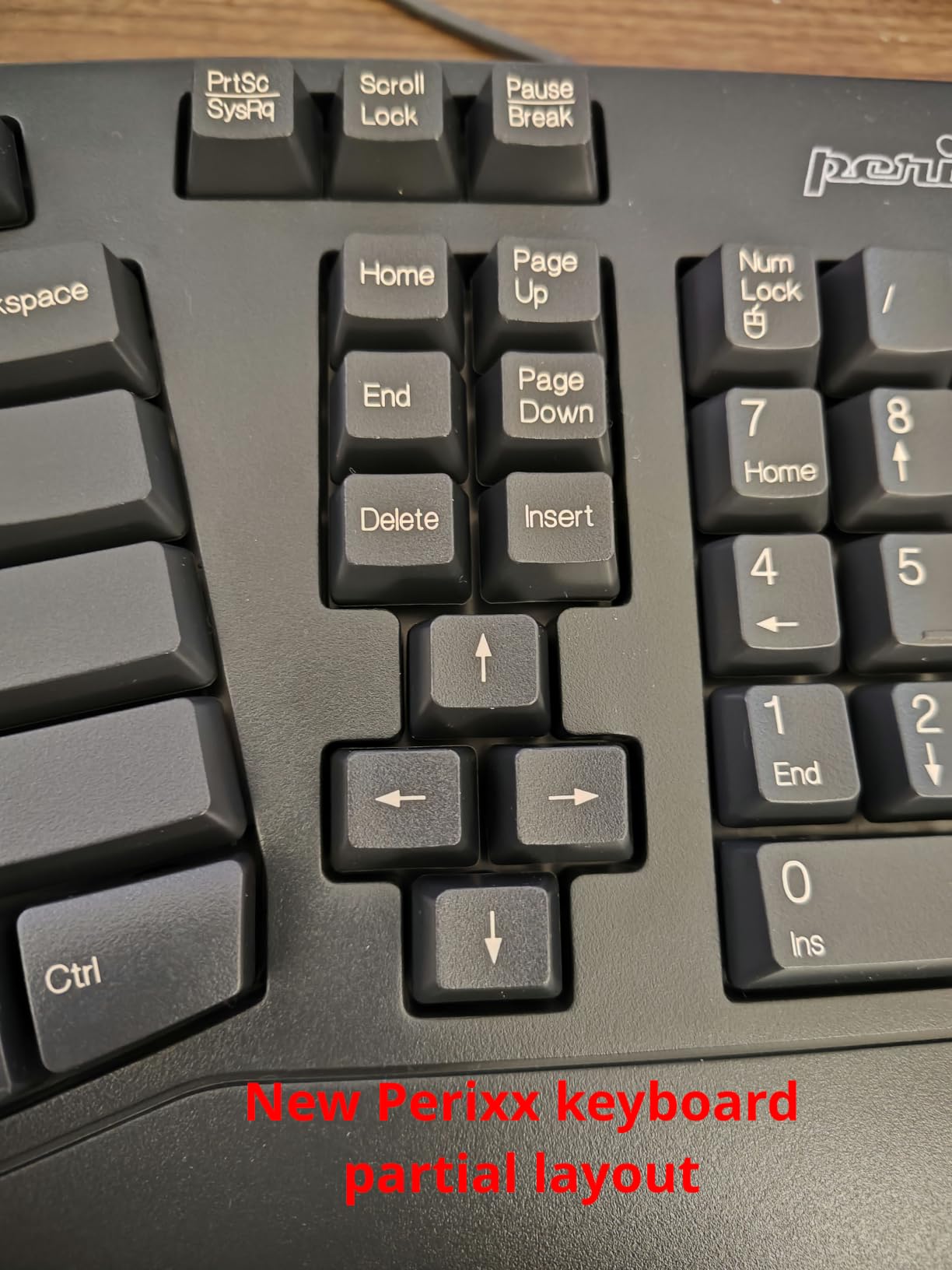 Perixx PERIBOARD-512B Wired Ergonomic Keyboard - Split Keyboard, Wrist Rest, Natural Typing - Wired USB Connectivity - US English - Black customer photo 1