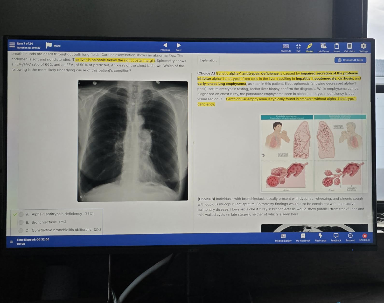 Acer 23.8in FHD 1920x1080 IPS 120Hz Office Monitor KB242Y G0bi customer photo 2