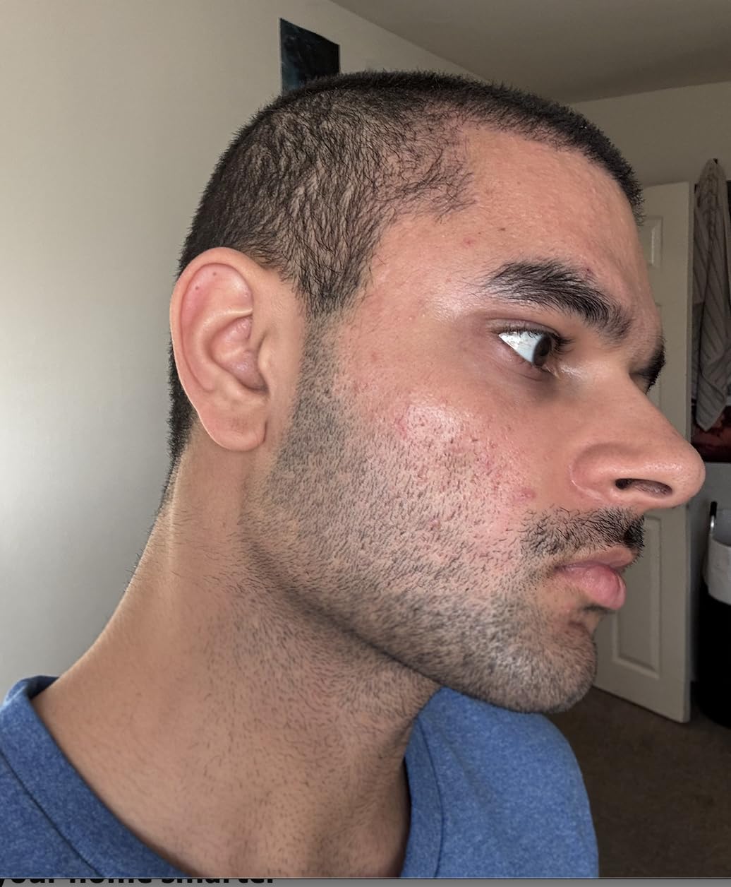 Philips Norelco i9000 Prestige Ultra Electric Shaver, Dark Slate | 360 Rotating NanoTech Precision Blades, SenseIQ Pro, 5 Shave Modes, Pressure & Motion Sensor, Quick Clean Pod, XP9402/86 customer photo 2